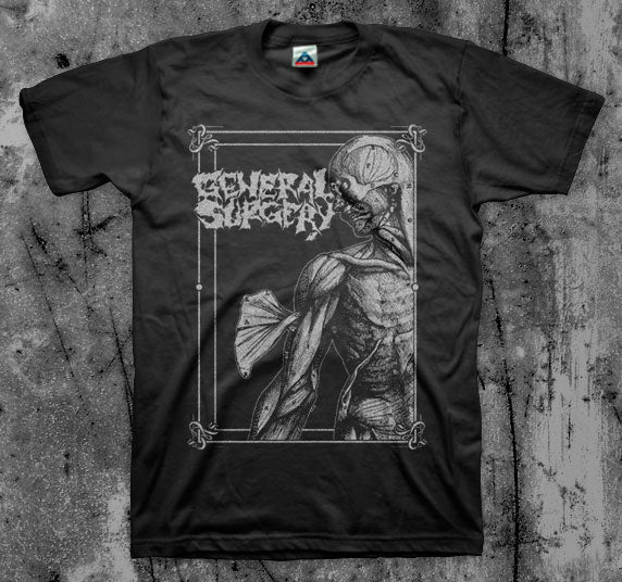 General Surgery